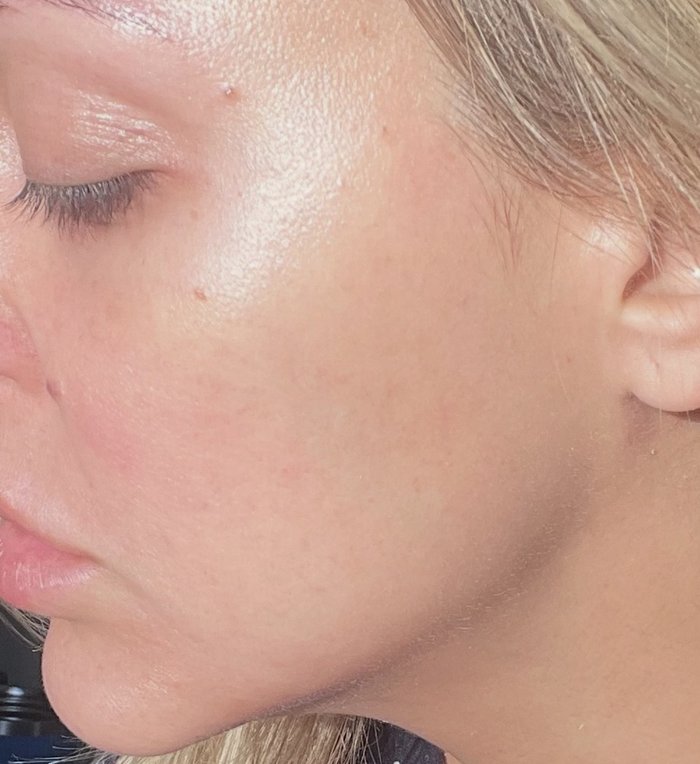 Side profile of a woman’s face with clear, glowing skin.